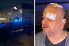 Tentata rapina nella Sunny Infissi. Titolare ferito alla testa dopo aver reagito