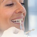 Faccette dentali a Borgomanero: cosa aspettarsi dopo il trattamento e come interpretare il periodo di adattamento