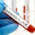 Coronavirus, in Puglia oltre 1500 nuovi casi nelle ultime ore