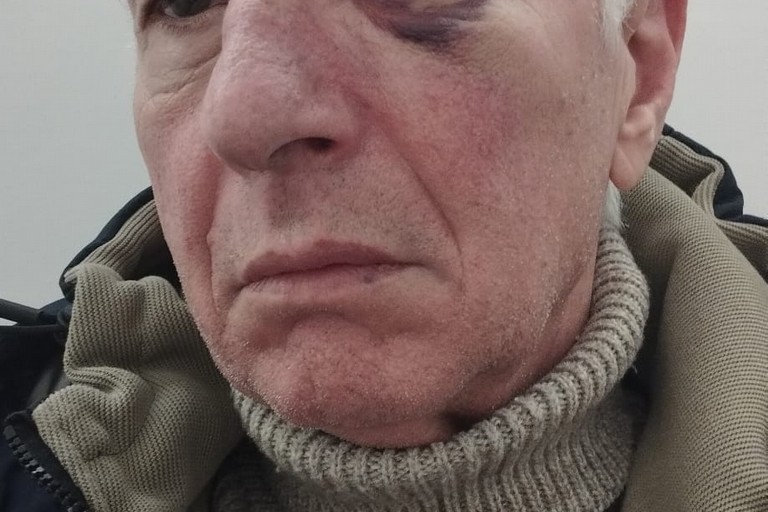 Aggredito da un pugno in corsia