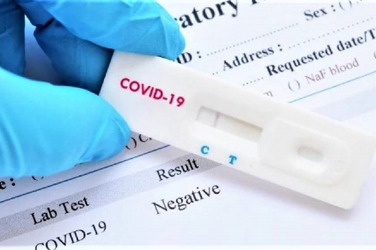 Test antigenico Covid